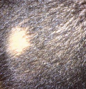 Alopecia areata